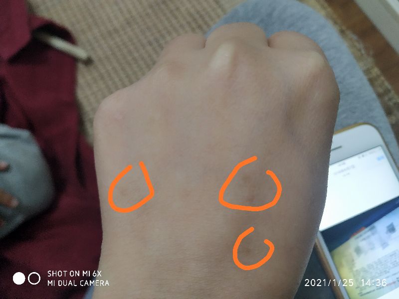 怀孕期间里面出血最有效保胎方法,孕期反复出血保胎经历