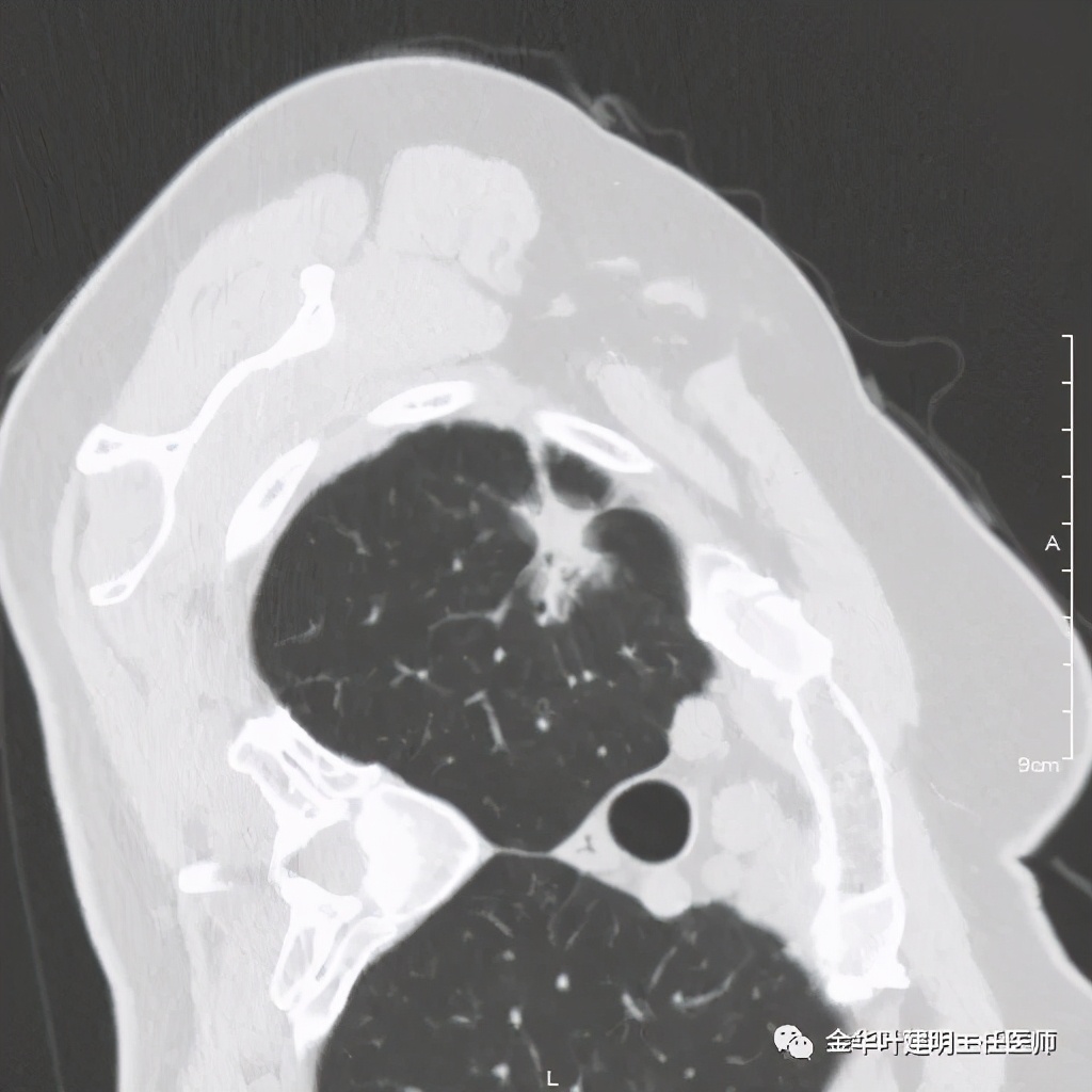 放个大招完整版教学,放个大招完整版前奏
