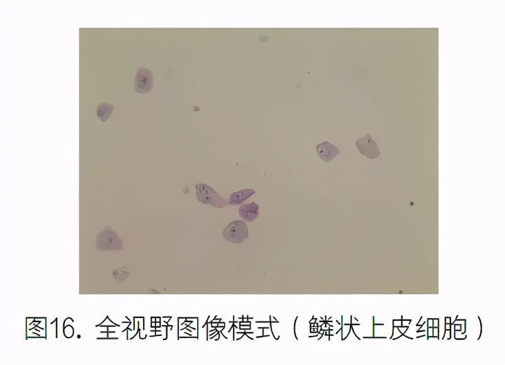 尿液有形成分分析的应用进展,尿液染色方法