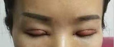 男的割双眼皮好看吗,割双眼皮好看吗动画