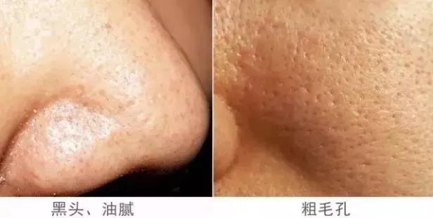 一块驴奶皂搞定洁面、卸妆,还能洗澡去鸡皮!我要回购10000次