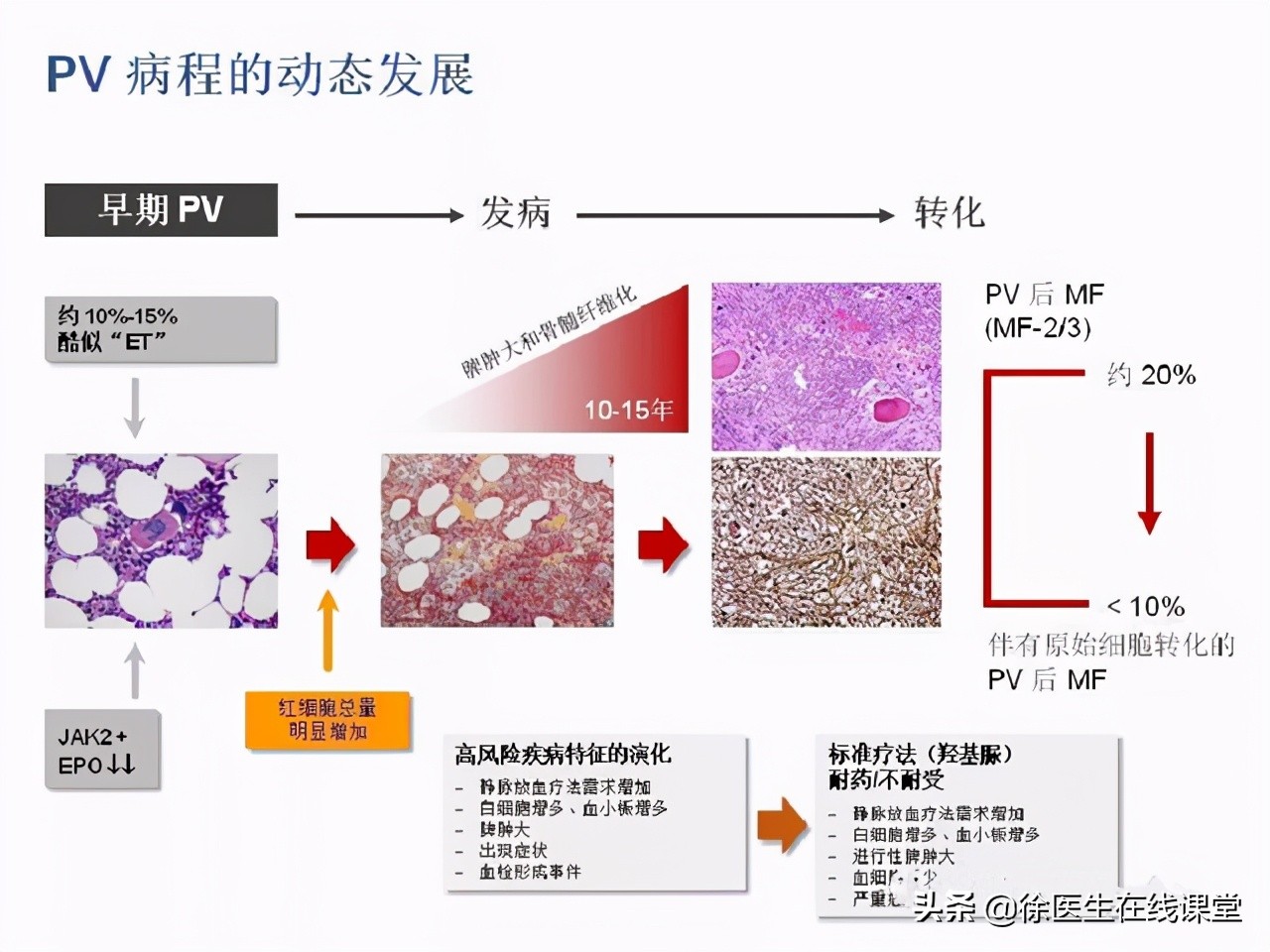 血常规能看出癌症转移吗,血常规能查出癌症骨转移吗