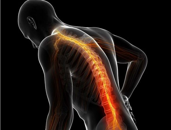 腰椎间盘突出并腰椎管狭窄怎么办,腰椎管狭窄腰椎间盘突出怎么治