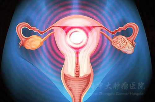 发现宫颈癌是整个宫颈切吗,发现宫颈息肉会是癌症吗