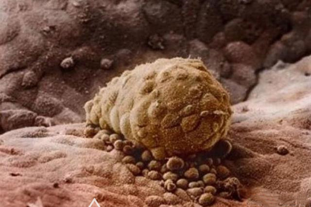 胎儿的生命历程,胎儿发育全程高清拍摄