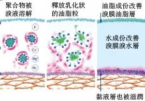 干眼症可以彻底治愈吗,干眼症能彻底治好吗