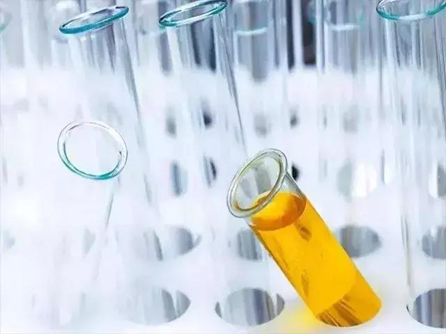 尿液呈红色就是血尿呢？真正的血尿要这样来区分