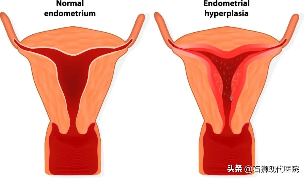 绝经后怀孕是什么症状,绝经后怀孕有啥反应