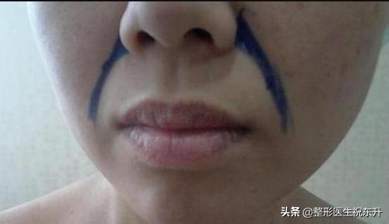 鼻子两边法令纹深怎么按摩改善,消除法令纹最好的按摩手法视频