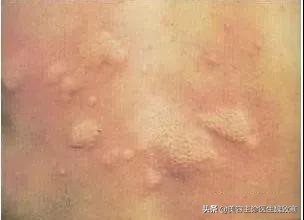 韩式纹眉有哪些种类,韩式纹眉痛吗