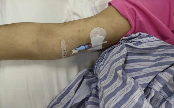 新辅助化疗肺癌病理完全缓解,宫颈癌术后辅助化疗