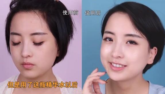 大s注射玻尿酸,大s爆料圈内美女