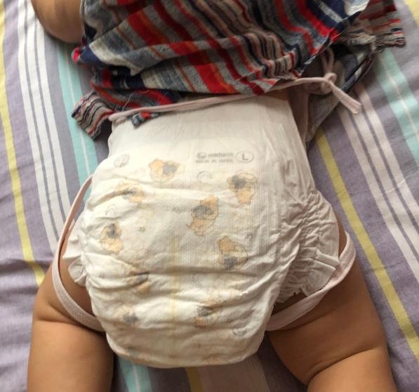 宝宝拉肚子后吃什么养肠胃,宝宝拉肚子需要家长留心吗