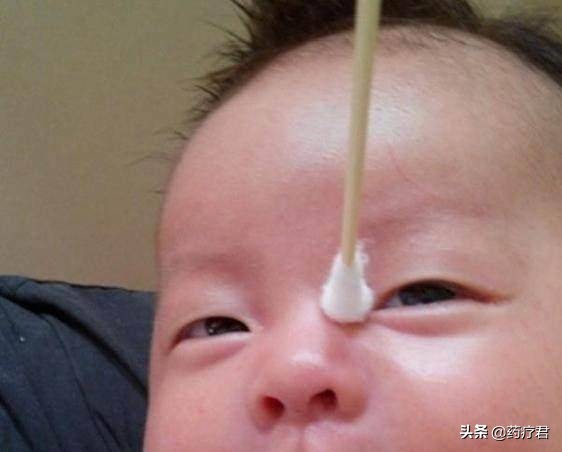 孩子眼屎多眼睛疼怎么回事,儿童眼屎多要去眼科吗