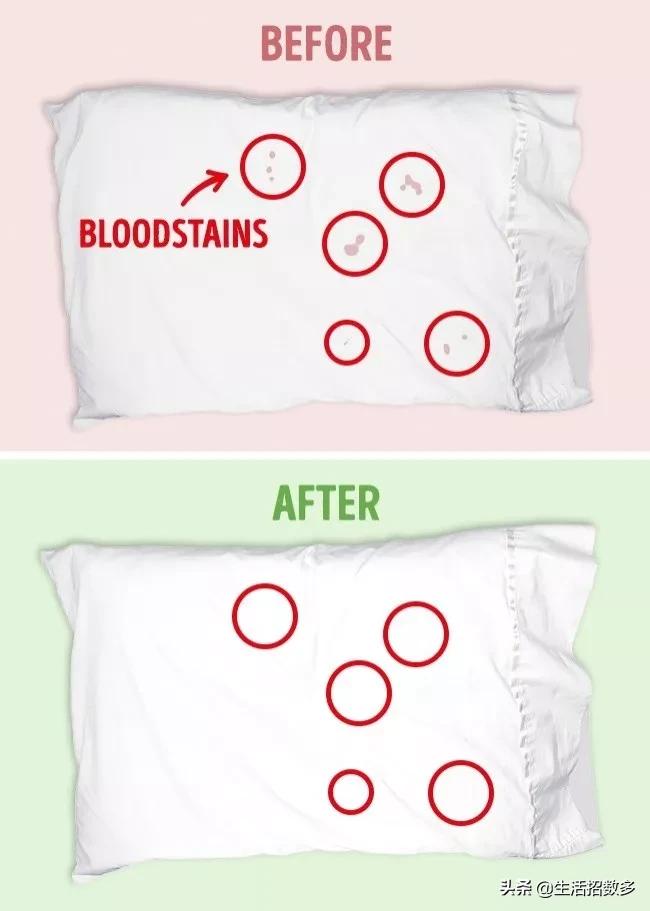 白色衣服发黄漂白剂洗得掉吗,衣服发黄了用84漂白剂可以漂白吗