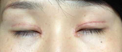 整形医生如何提高审美,十年前的整形审美和现在的审美