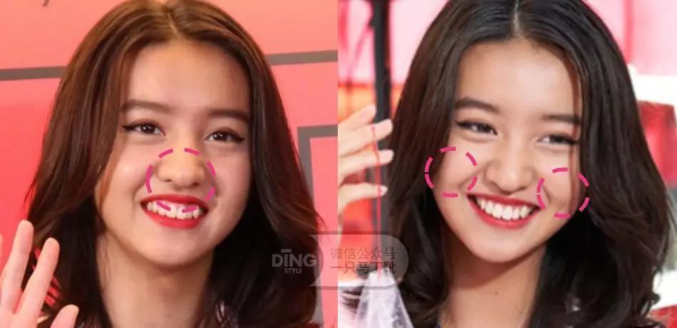 凸嘴微笑练习方法表情管理,前凸嘴怎么做表情管理