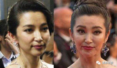 解决眼部干纹黑眼圈最好的方法,黑眼圈眼袋干纹怎么消除