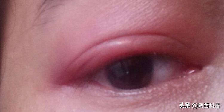 吃辣食物可以减肥吗,吃辣加速减肥