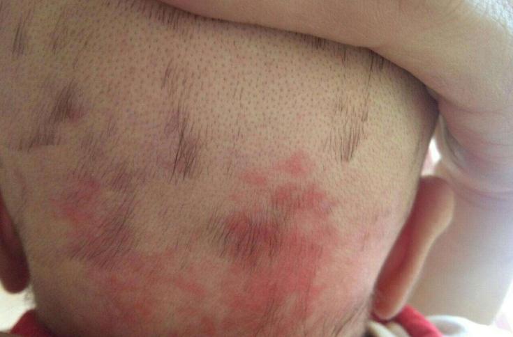 19岁少女乳头一直没长出来,不要听信“老人言”,这种错误犯不得