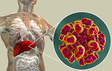 女性肚皮上长痣是肝有问题么,樱桃痣是肝不好吗
