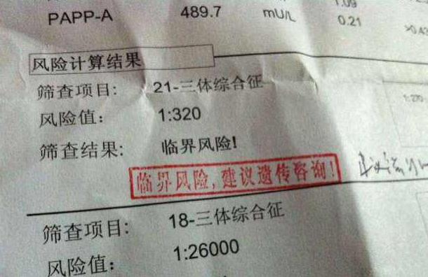 唐氏筛查临界风险做无创会高危吗,唐氏筛查临界风险需要如何解决