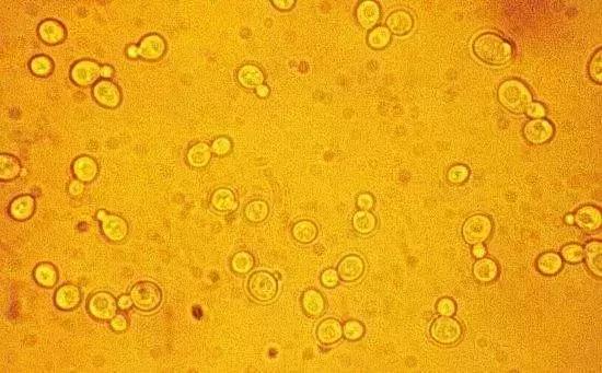 酵素肥料如何使用到果树上,环保酵素在柑橘果树上的使用方法