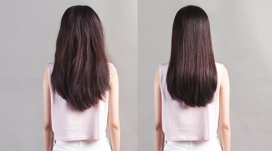 远离脱发这4个问题你需要知道,脱发问题越来越常见了