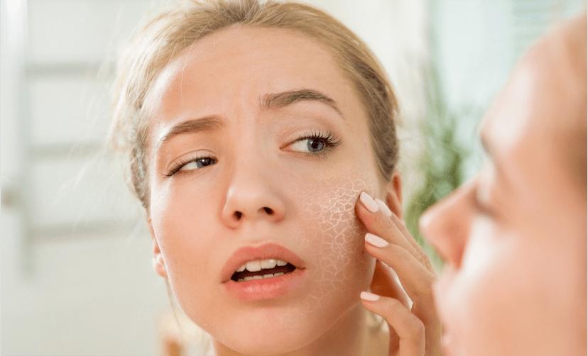 脸蛋特别干燥脱皮是怎么回事,脸脱皮干燥怎么办快速解决