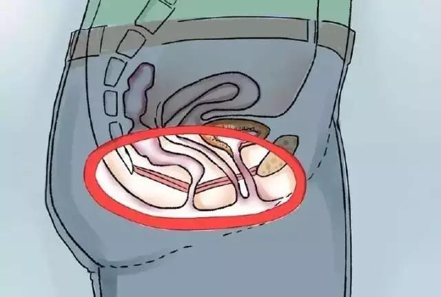 产后漏尿尴尬,产后漏尿如何避免