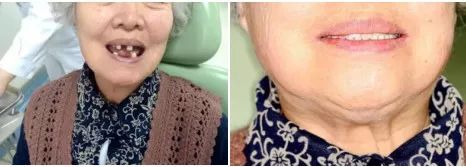 90后整牙破产,90后因为吃喝玩乐负债3万