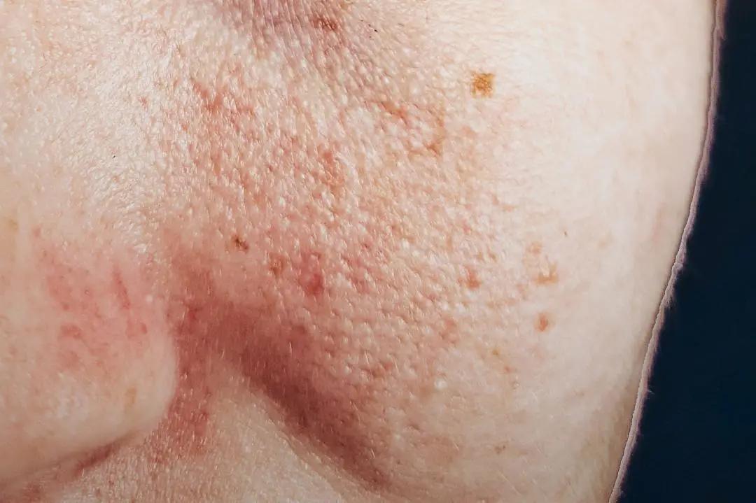 青春期的小孩怎么护肤,学生党在青春期如何正确护肤