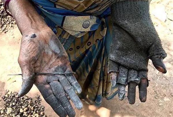 腰果科普知识,腰果哪部分有毒