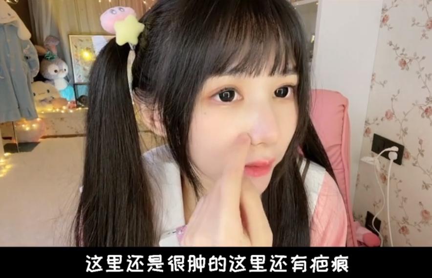 千万网红整容,女子整容失败变巫婆鼻