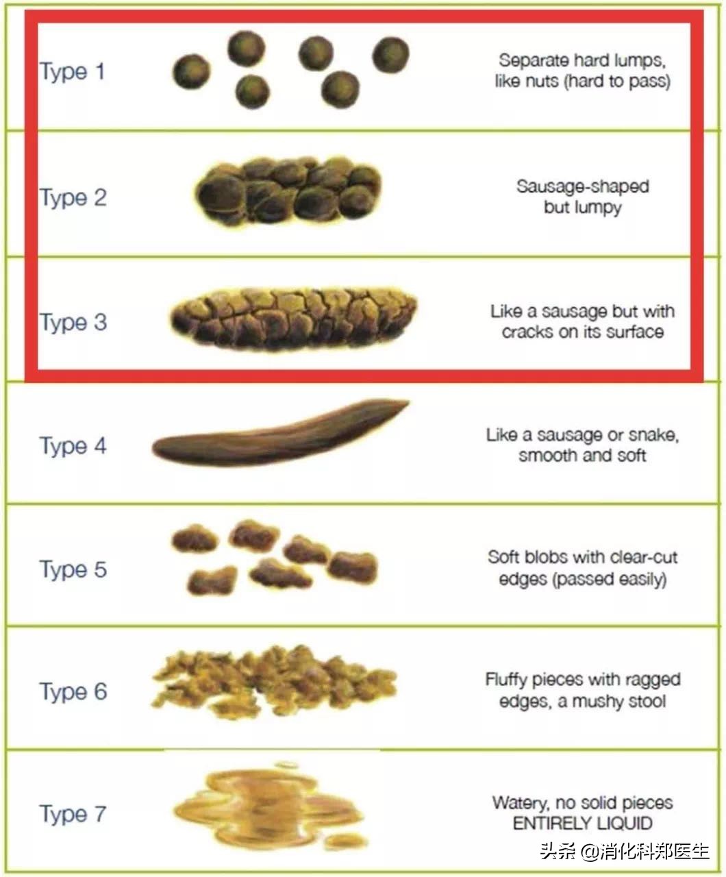 碧生源能治便秘吗,碧生源哪款治疗便秘效果最好