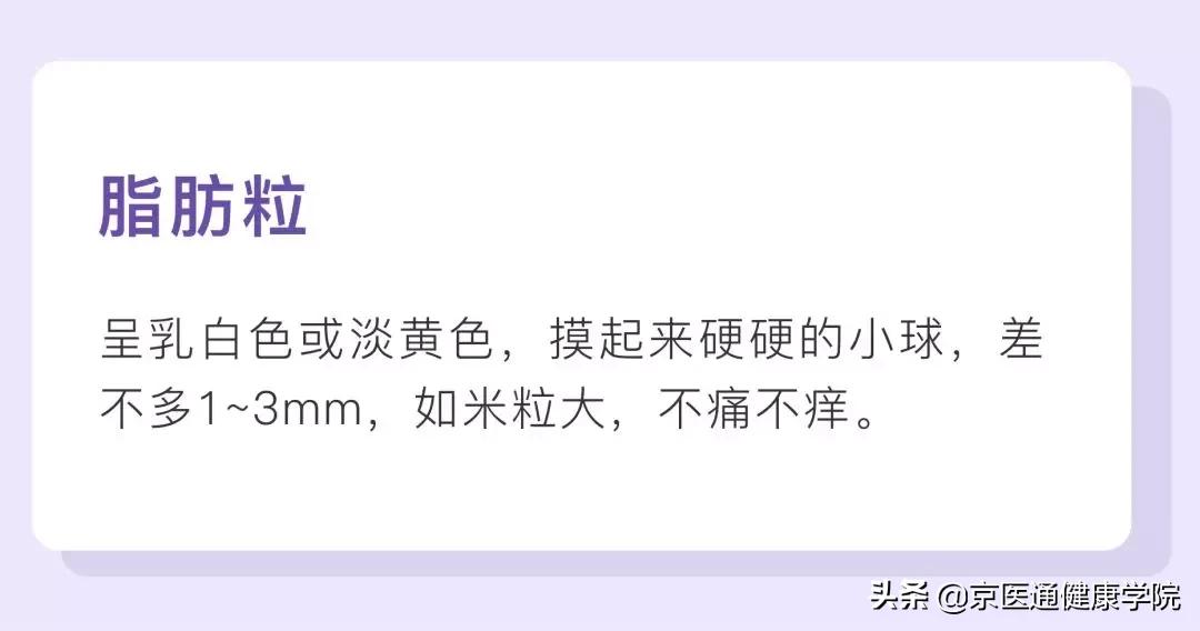 粟丘疹与汗管瘤脂肪粒去除小妙招,粟粒疹扁平疣