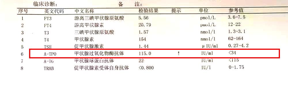 甲亢碘131治疗亲身经历,从甲亢到甲减的最典型症状表现