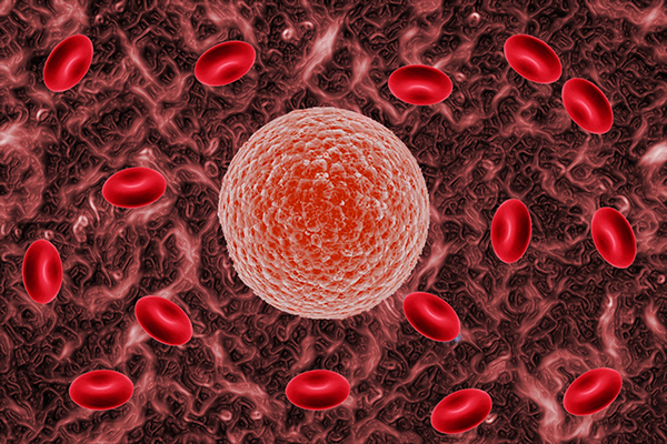 连续2次胎停,应该怎么办?不要过度自责,备孕前的检查很重要