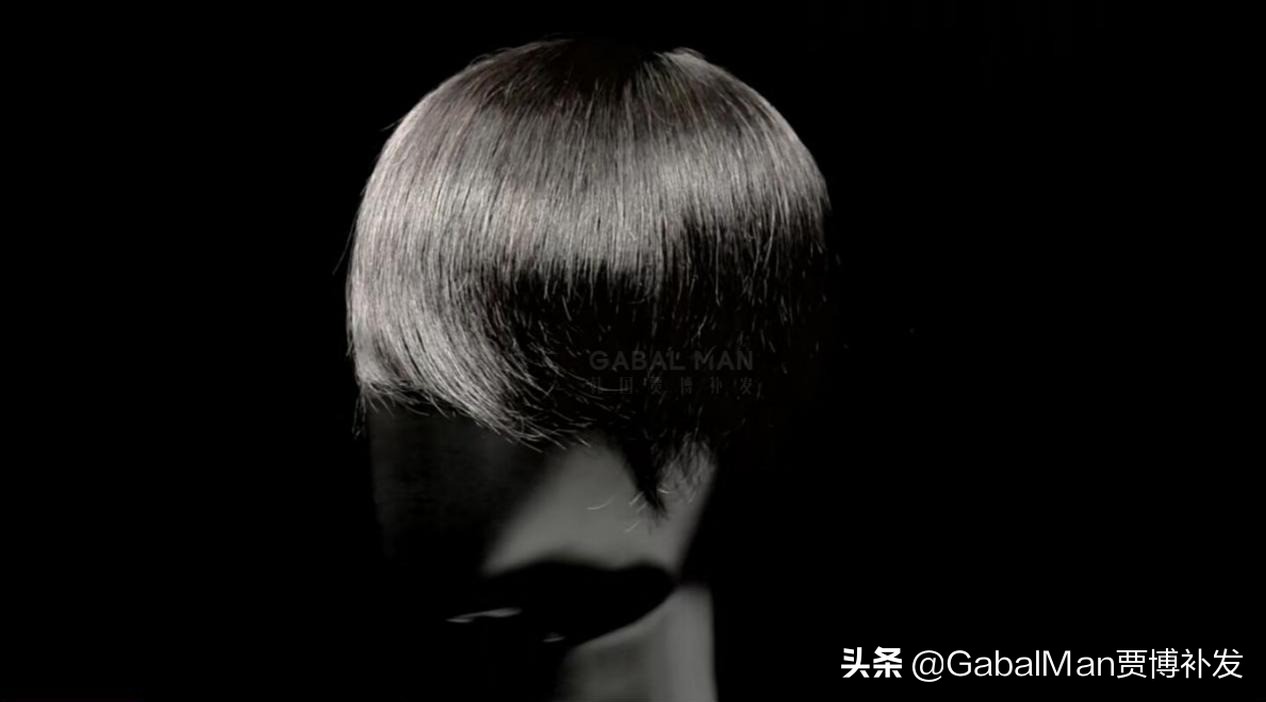 脱发不生发与身体有原因吗,脱发为什么不愿意理光头