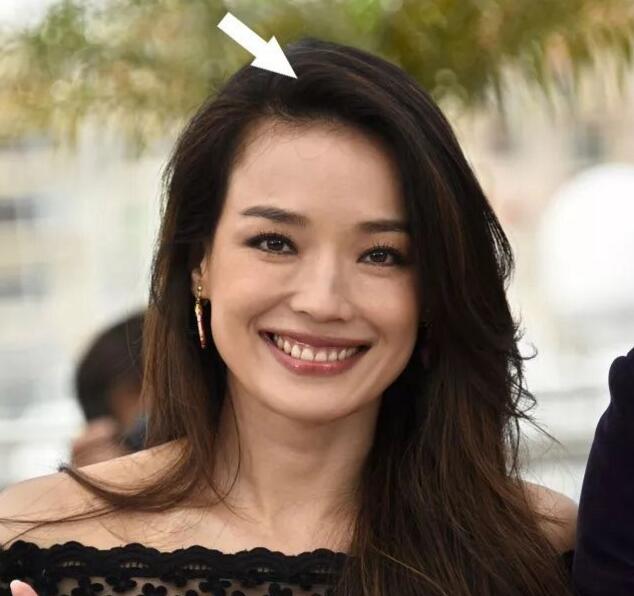 头发细软贴头皮怎么改善,头发细软贴头皮