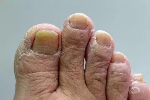 行军拉练，是时候保护好自己的“面子”了