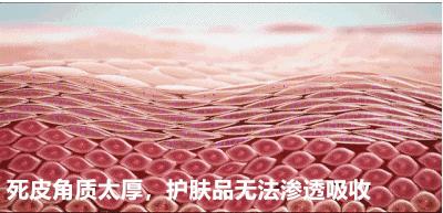 洗澡搓出来的泥每天都可以洗,洗澡搓出来的泥增多了