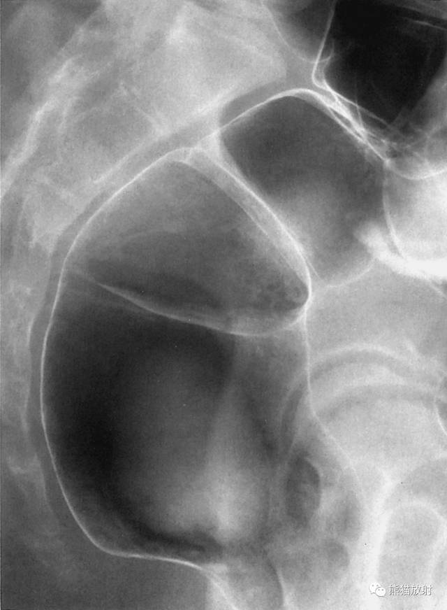 详细的消化道造影+彩色解剖图