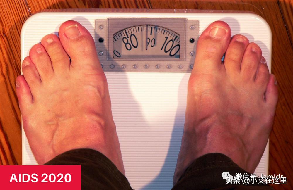 抗病毒治疗艾滋病经历,感染艾滋病多久会体重下降厉害