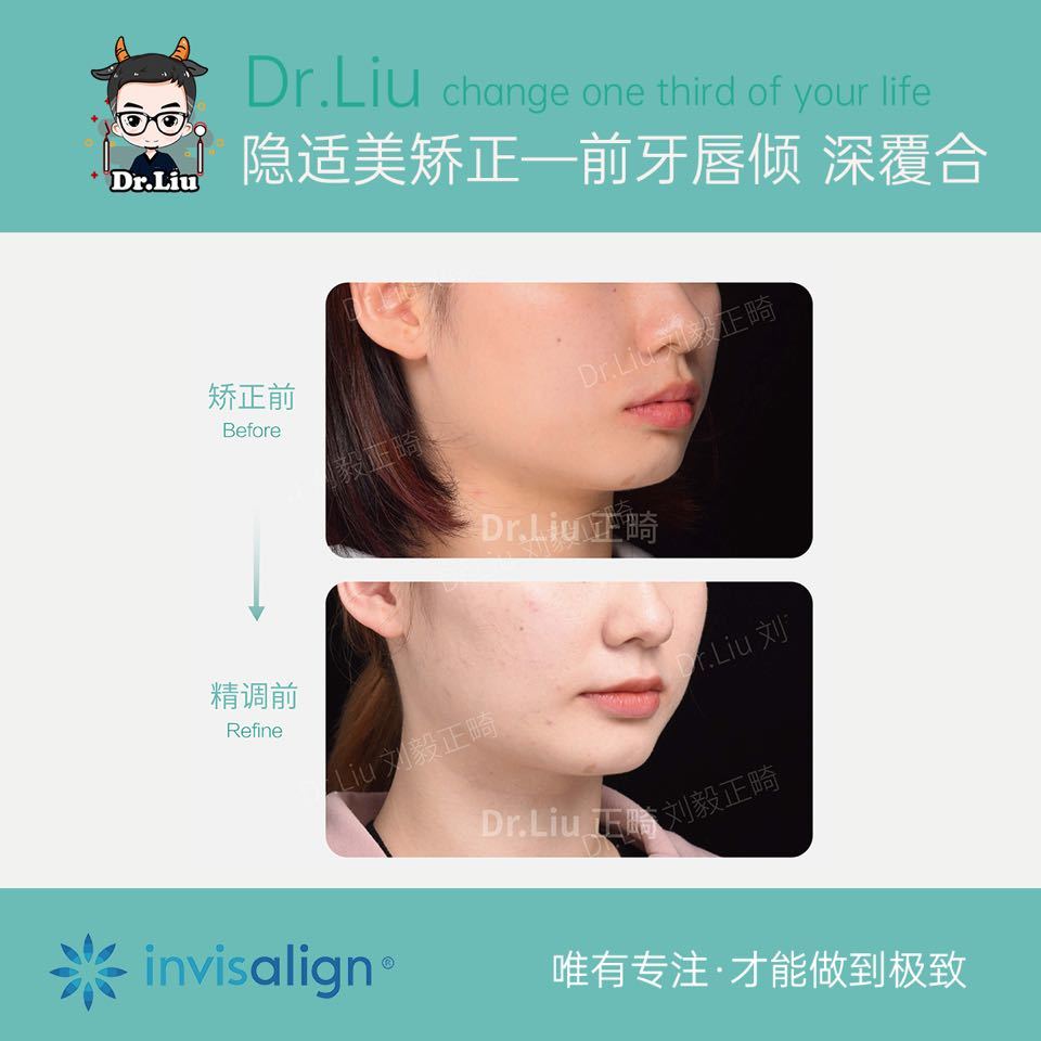 鍘﹂棬鐗欓娇缇庡,鍘﹂棬鐗欓娇鐭闅愬舰姝g暩