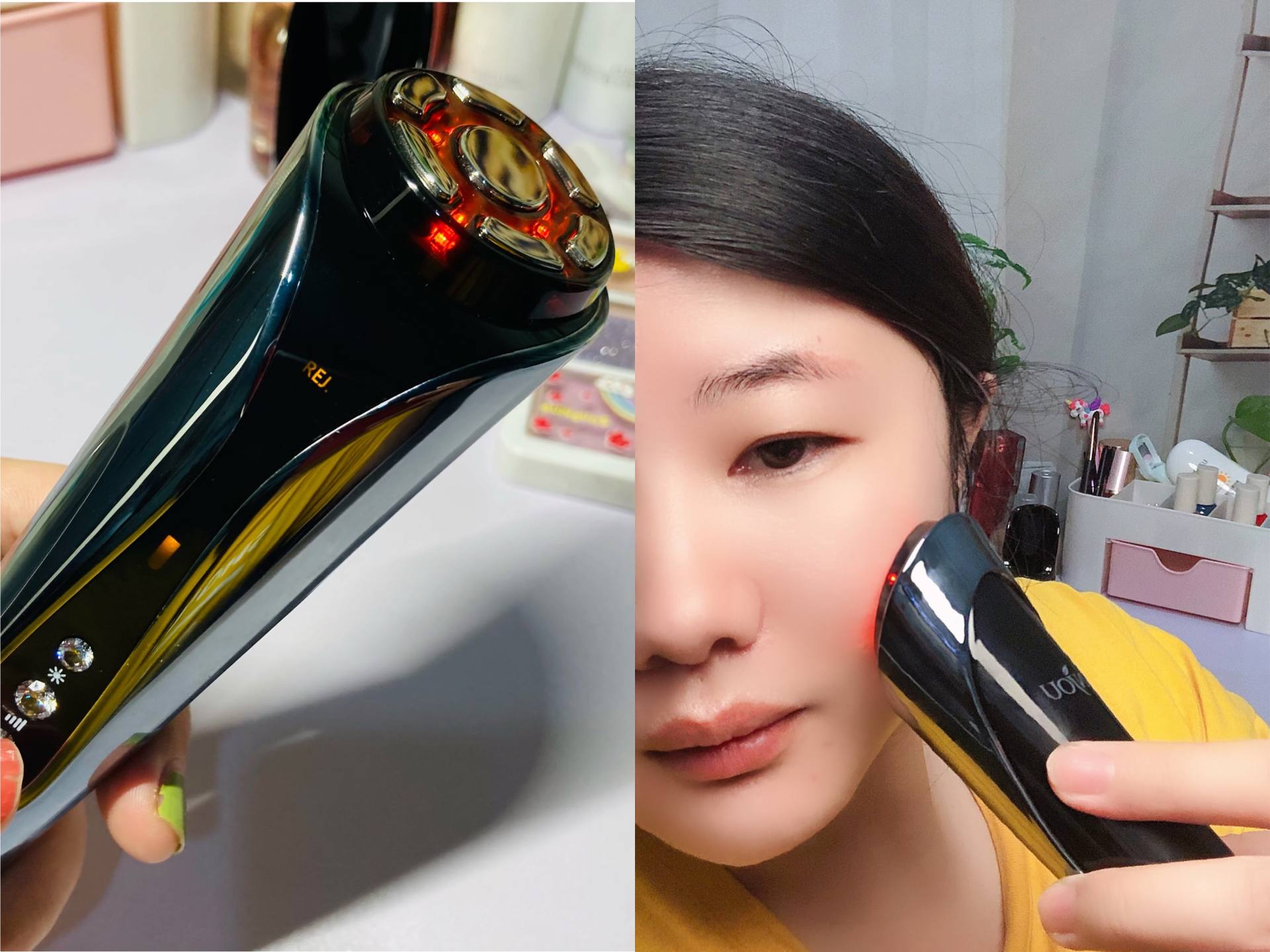 anjou射频仪,anjou美容仪测评