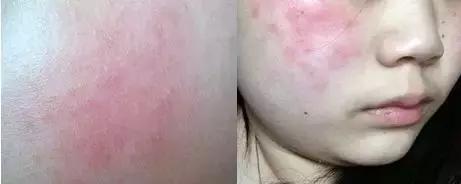 濂界墿娼祦鏉ヨ,鑳跺師鎶楄“绮惧崕