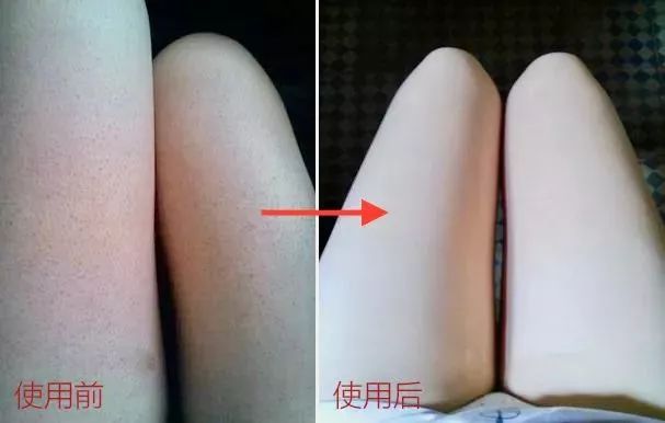 一块驴奶皂搞定洁面、卸妆,还能洗澡去鸡皮!我要回购10000次