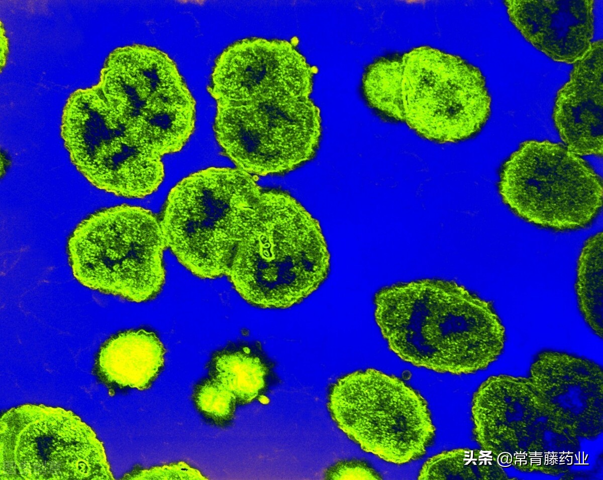 淋病治疗需要注意什么,淋病检查都需要做哪些