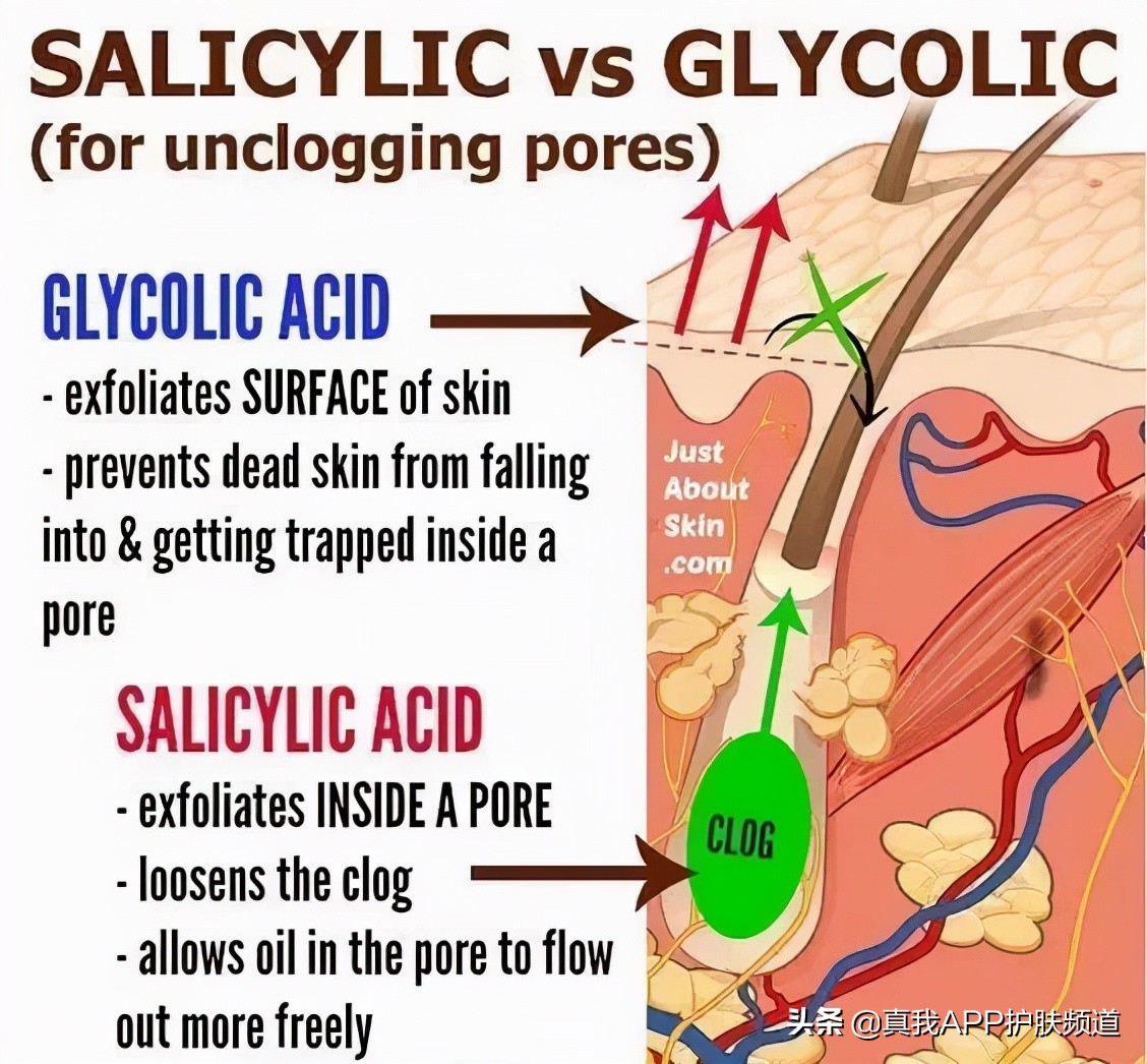 什么护肤品去黑头收缩毛孔最好,收缩毛孔的护肤品哪个效果好点